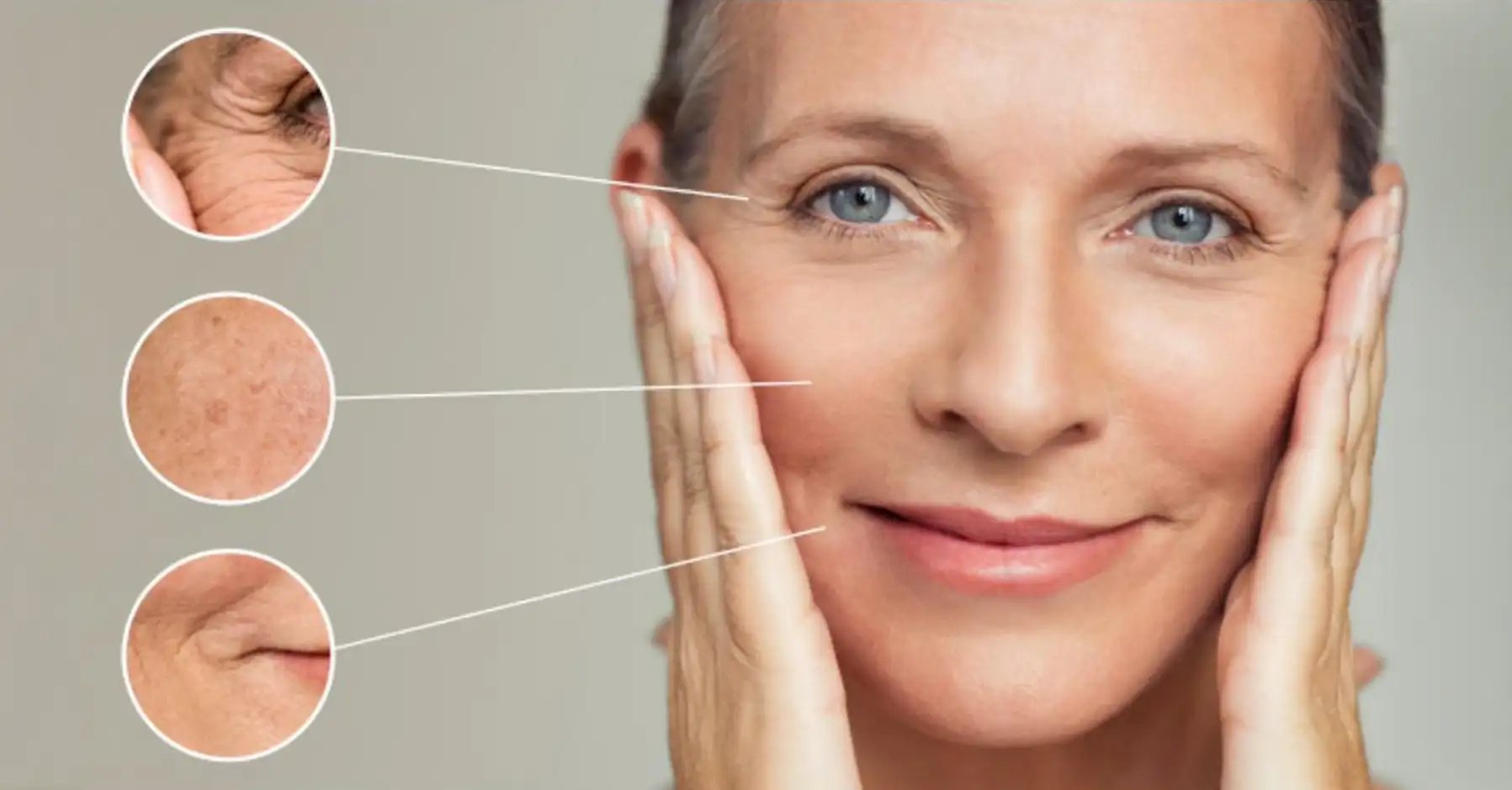 Huidveroudering Huidveroudering